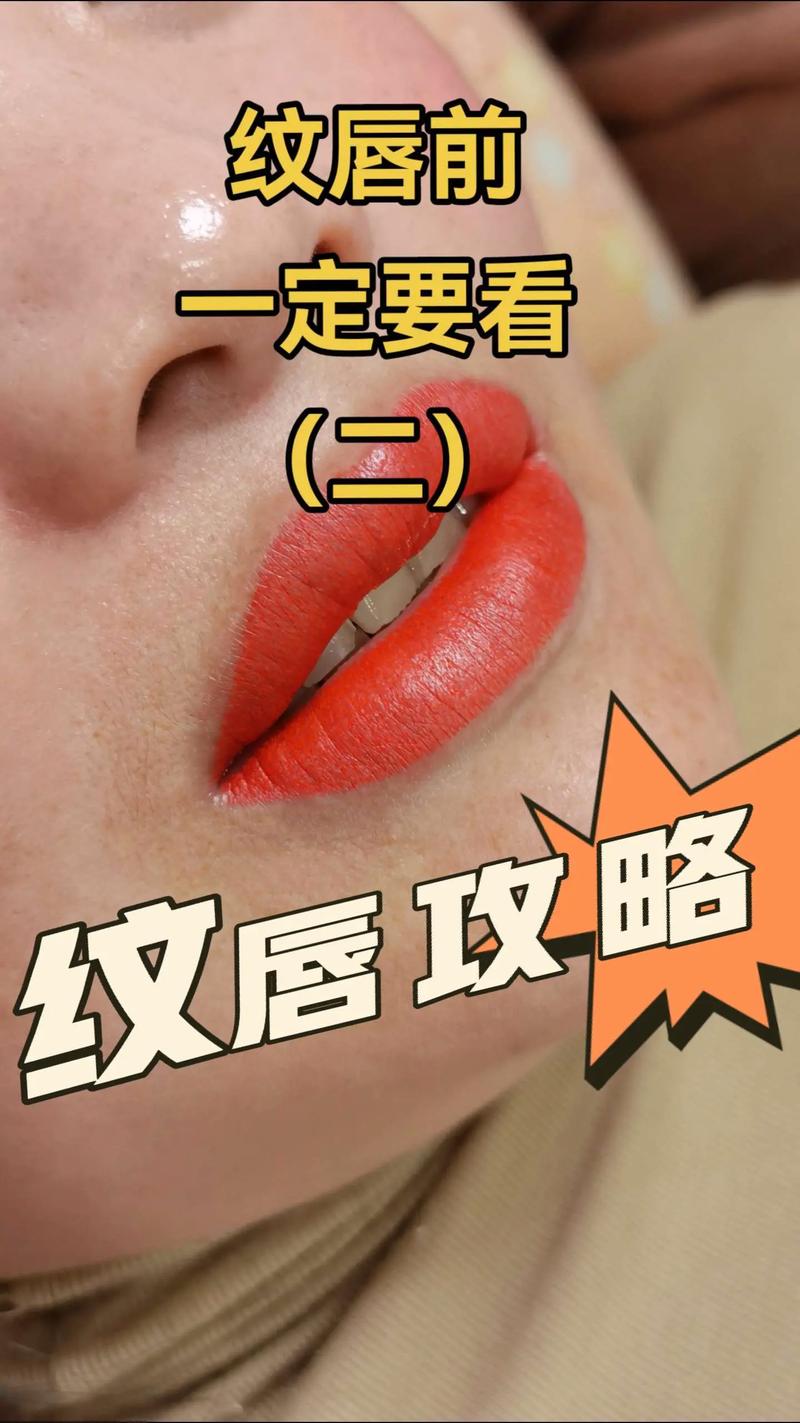 是什么纹唇