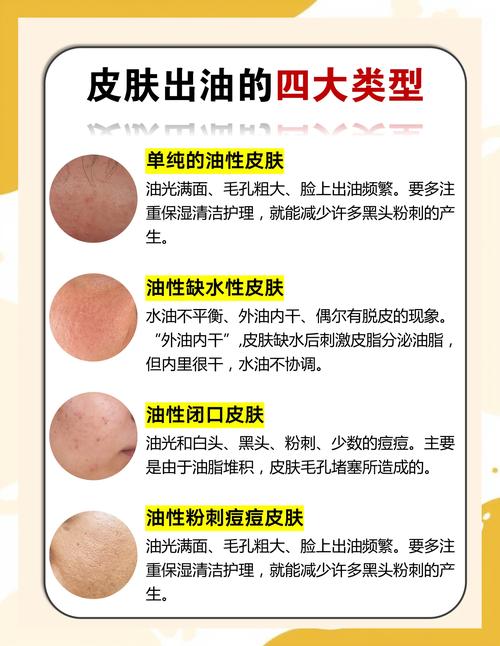 洗面奶用了长痘怎么办