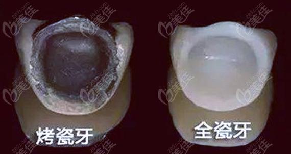 崩瓷是什么意思