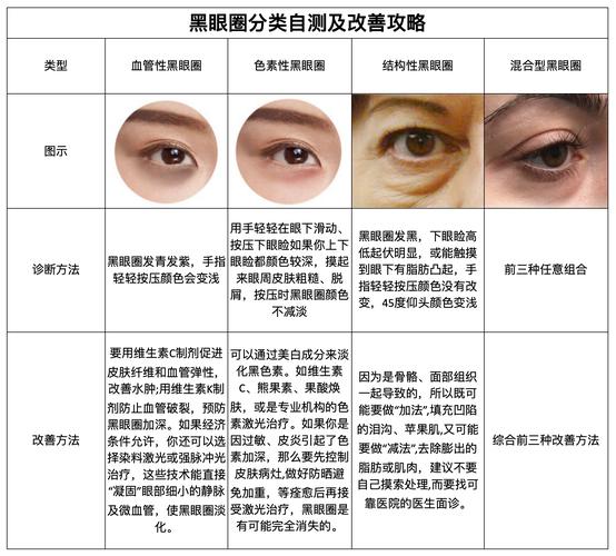 什么是黑眼圈图片