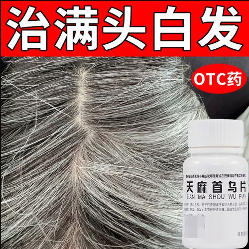 女性脱发吃什么药好