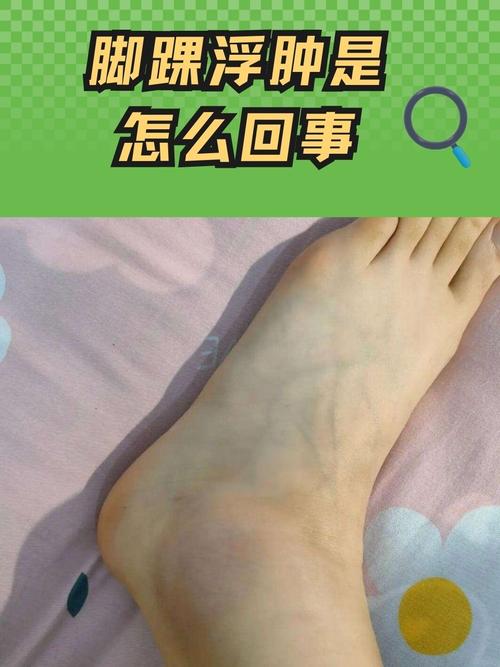 脚踝粗是什么原因