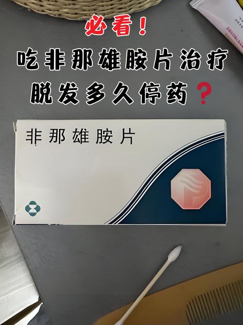 脱发用什么药物治疗