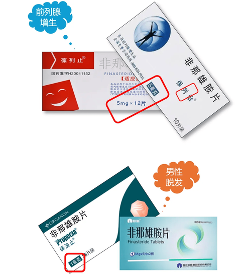 脱发用什么药物治疗