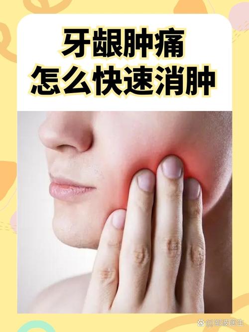 为什么老是牙龈肿痛