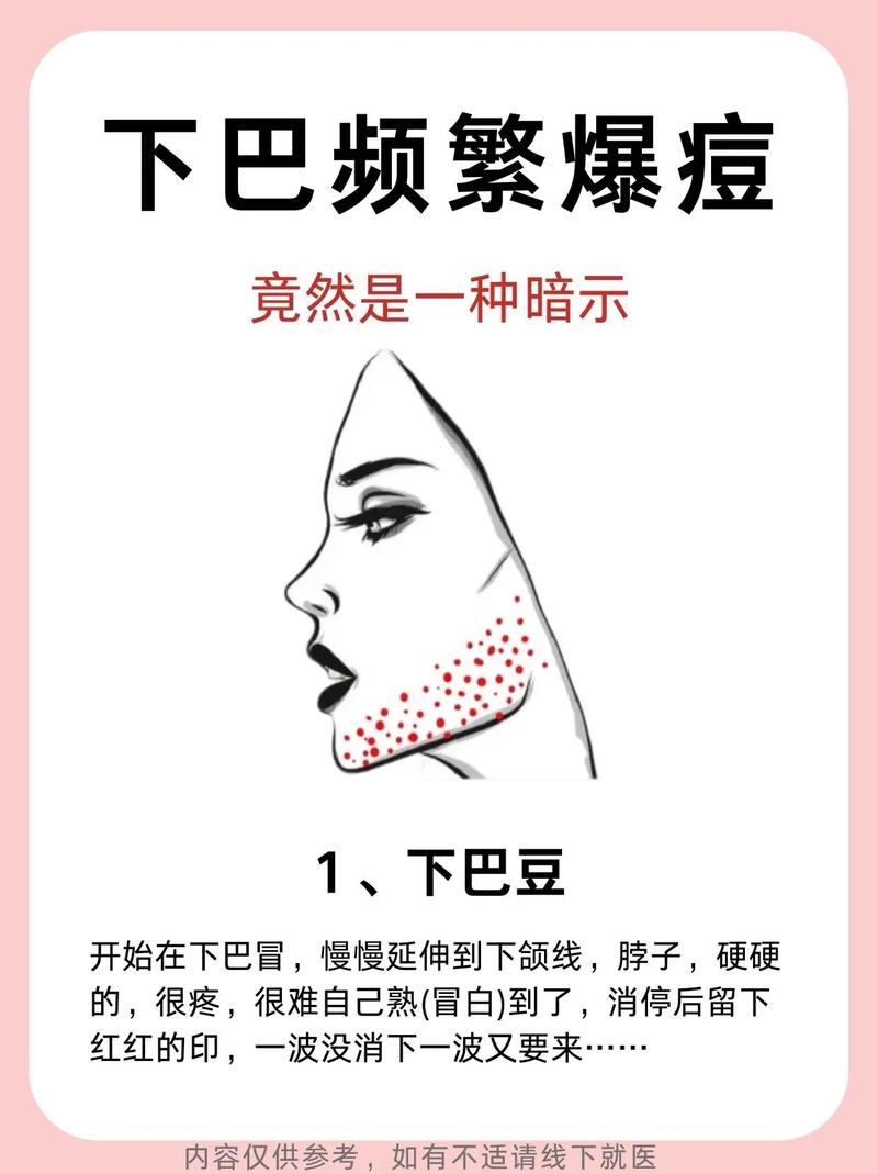 下巴长痘代表什么