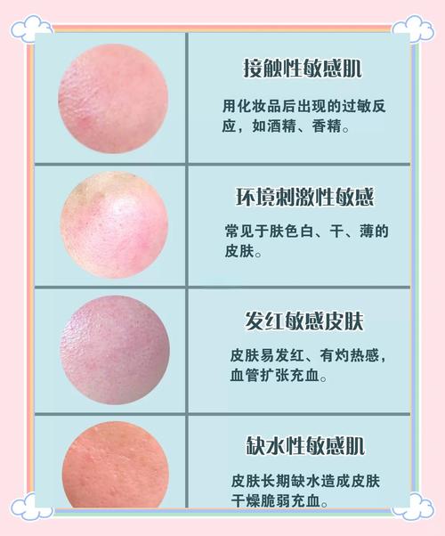 敏感肌肤什么意思