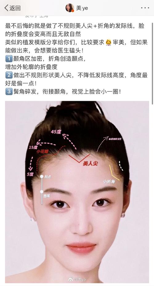 什么叫美人尖