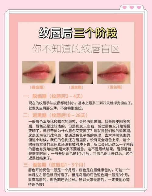 纹唇注意什么
