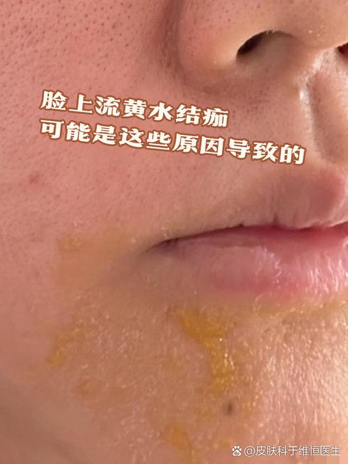 脸黄是什么原因引起的
