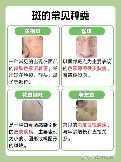脸上起斑是什么原因