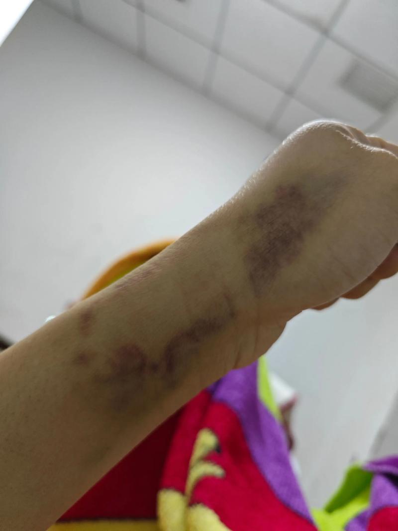 喝醉酒打什么针