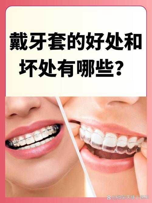 带牙套有什么作用