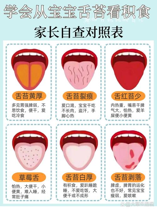舌干燥是什么原因