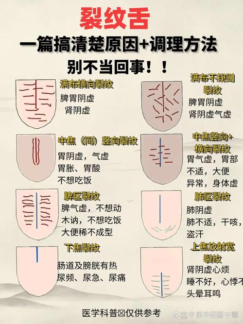舌干燥是什么原因
