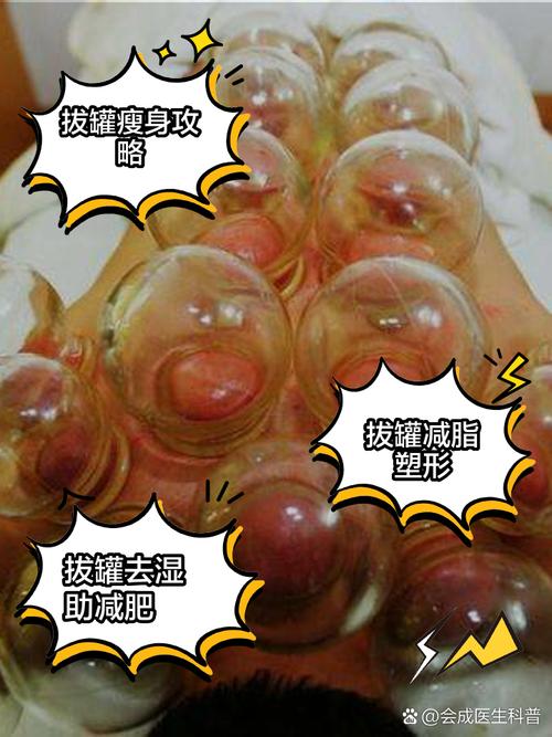 拔罐减肥什么体质最好