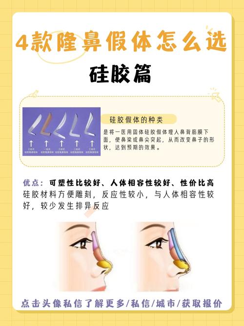 假体隆鼻什么好