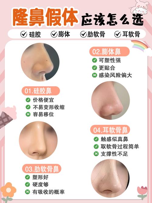 假体隆鼻什么好