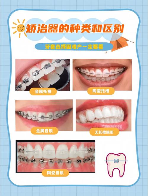 矫正牙齿有什么坏处