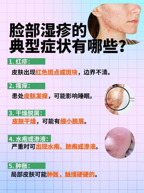 脸湿疹什么引起的