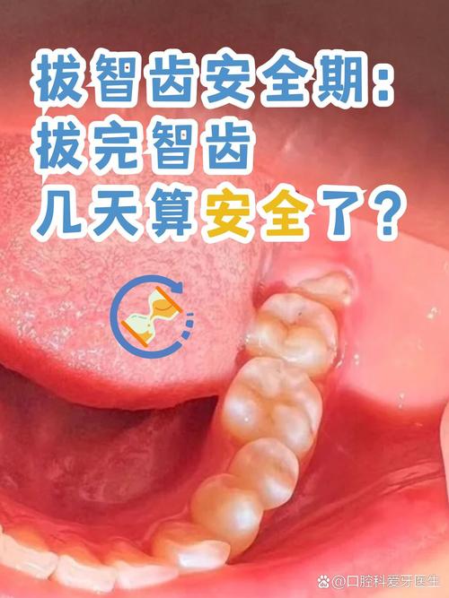 拔牙是什么科