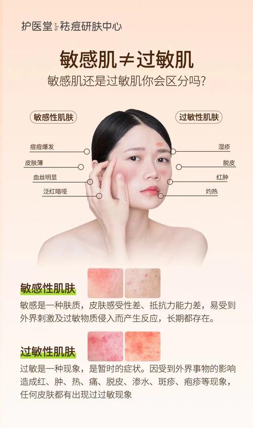 什么是过敏肌