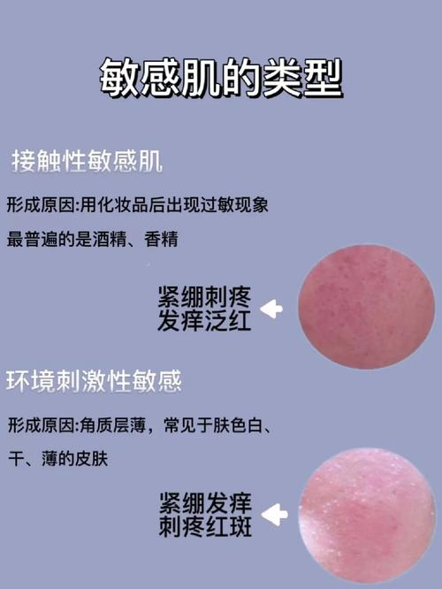 什么是过敏肌