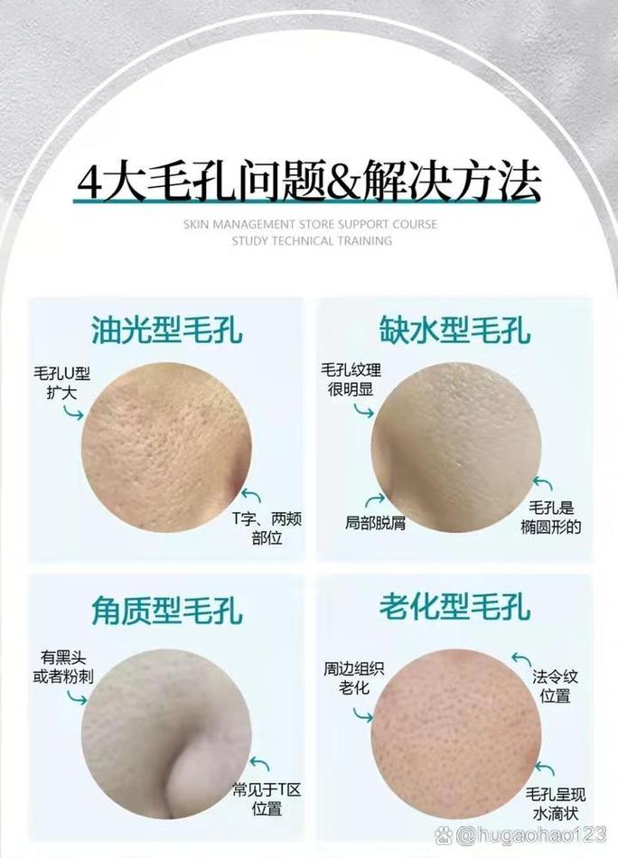 什么收毛孔