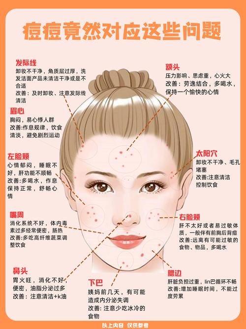 眉间长痘痘什么原因