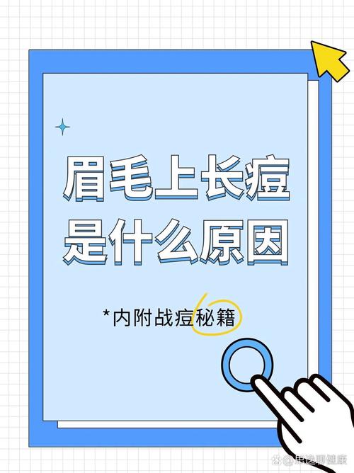 眉间长痘痘什么原因