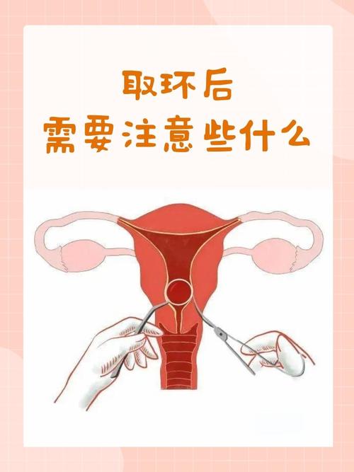 取环前要注意什么