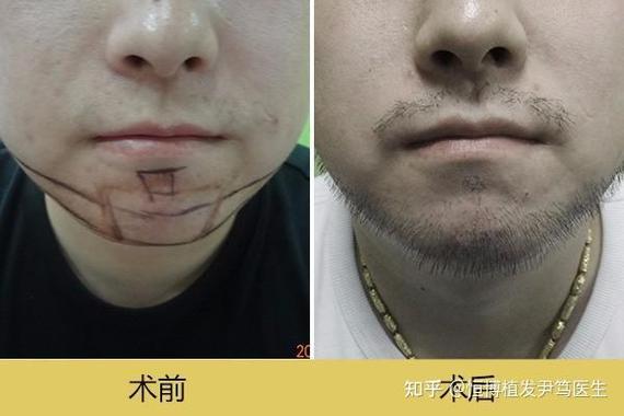 胡子少是什么原因