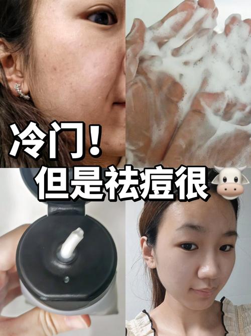 洗面奶用完长痘痘怎么回事