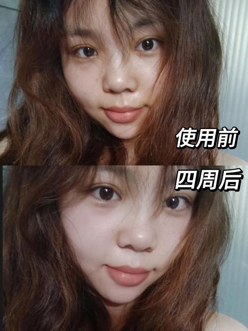 洗面奶辣鼻子和眼睛怎么回事