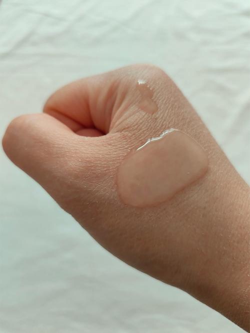 敏感肌用什么爽肤水