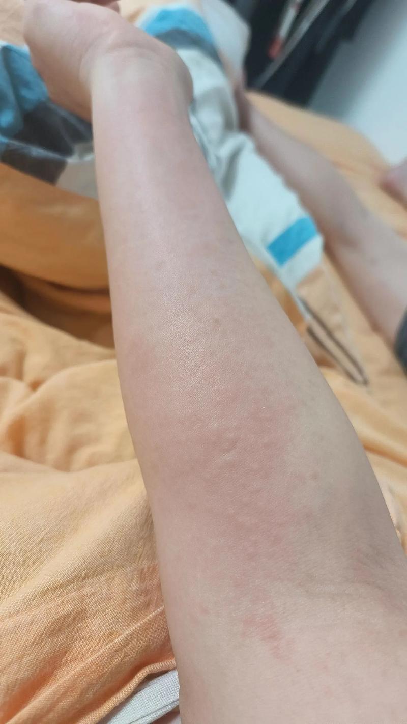 什么是寻麻诊
