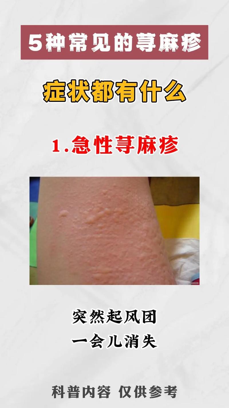 什么是寻麻诊