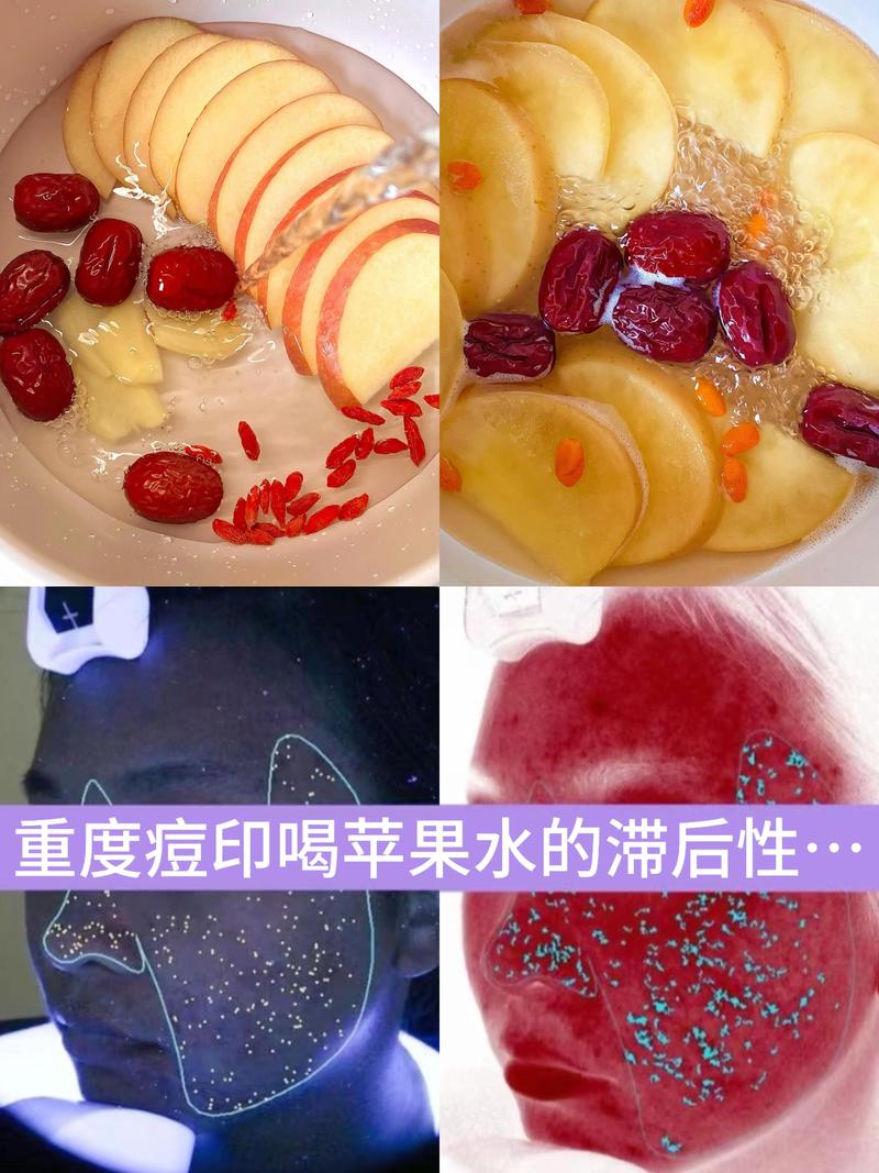 喝什么去痘印