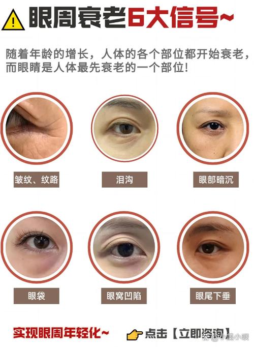 什么是干纹