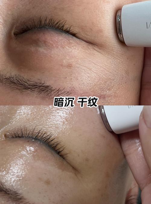 什么是干纹