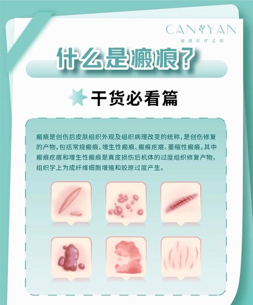 癫痕是什么