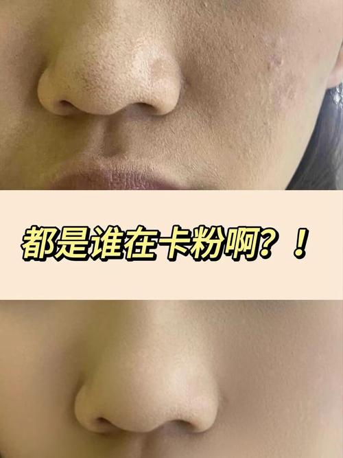 卡粉为什么