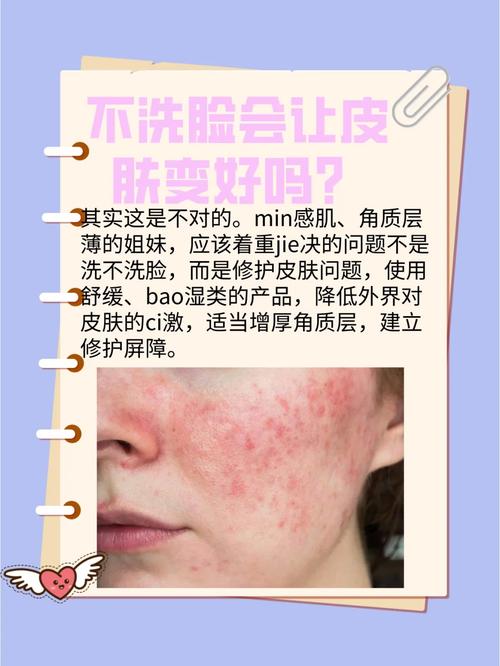 不用洗面奶皮肤好了怎么回事