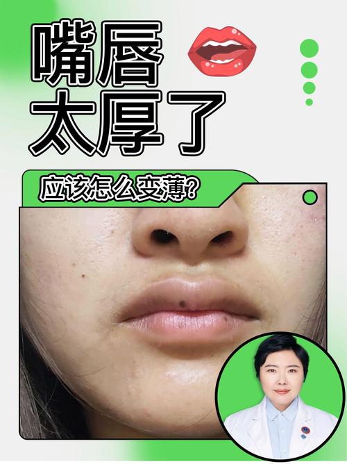 为什么嘴唇越来越厚