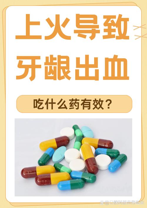 牙龈炎出血吃什么药