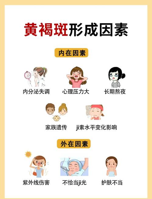 长蝴蝶斑什么原因