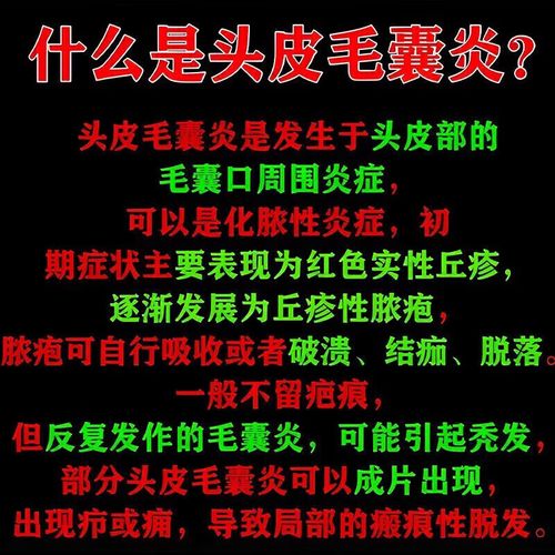 头部毛囊炎用什么药
