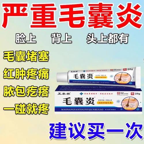 头部毛囊炎用什么药