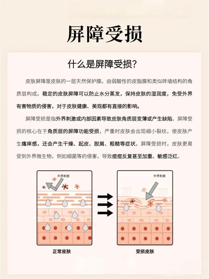皮肤屏障是什么意思