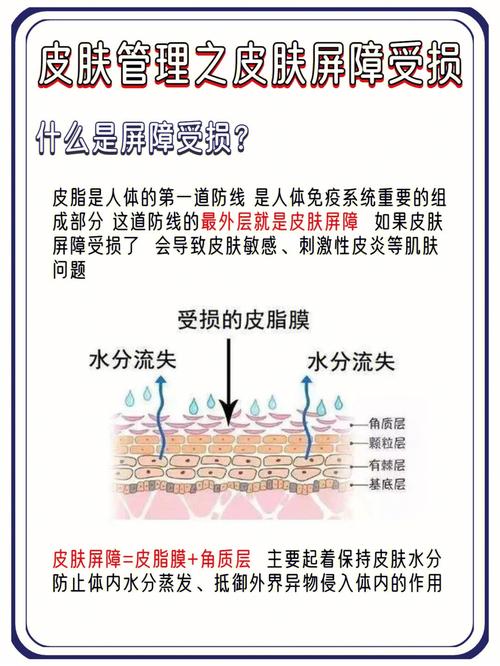 皮肤屏障是什么意思